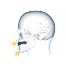 Load image into Gallery viewer, Shock Dr. Gel Nano Muces Protector - Blue
